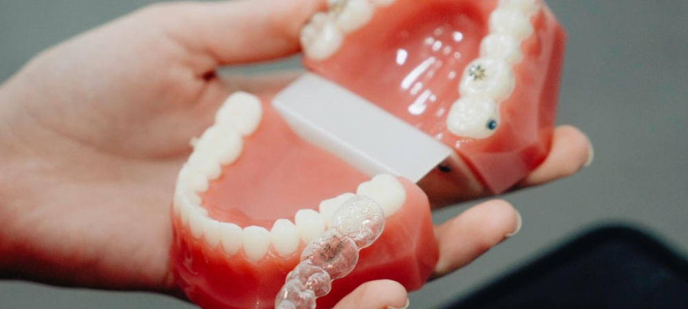 invisalign Padova
