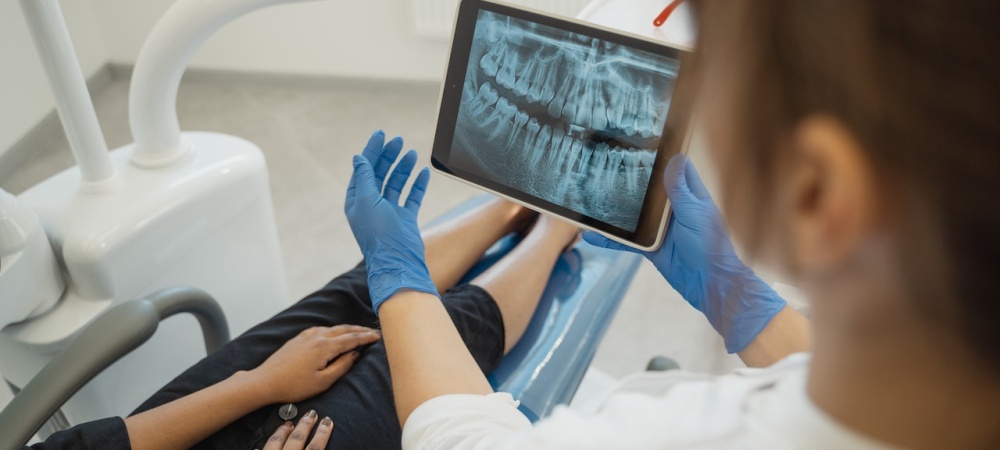 Radiografia Dentale Padova