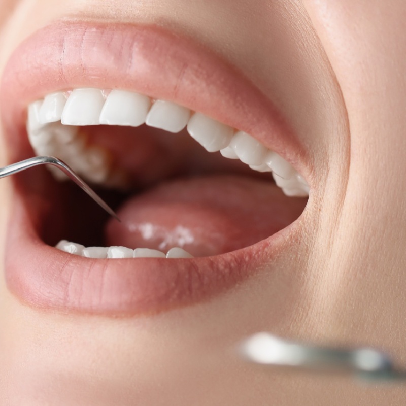 Estetica dentale a Padova